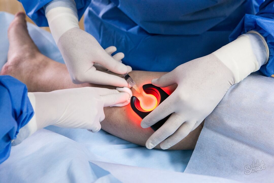 Different leg veins diagnostics