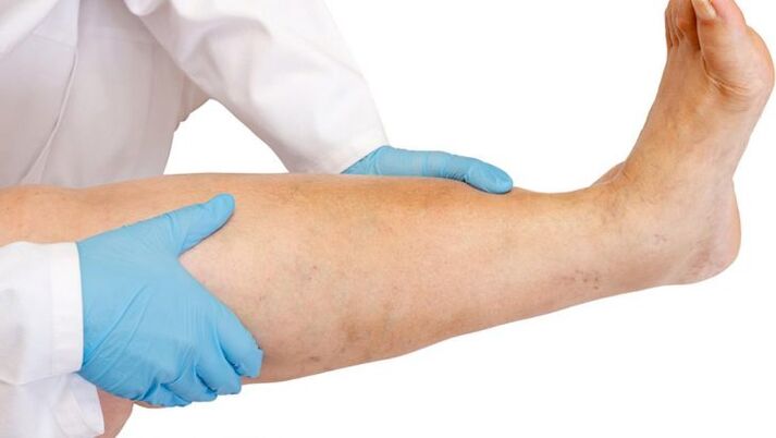 how to recognize the disease